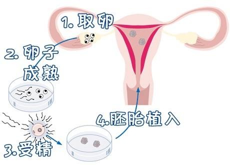 Dr. Li